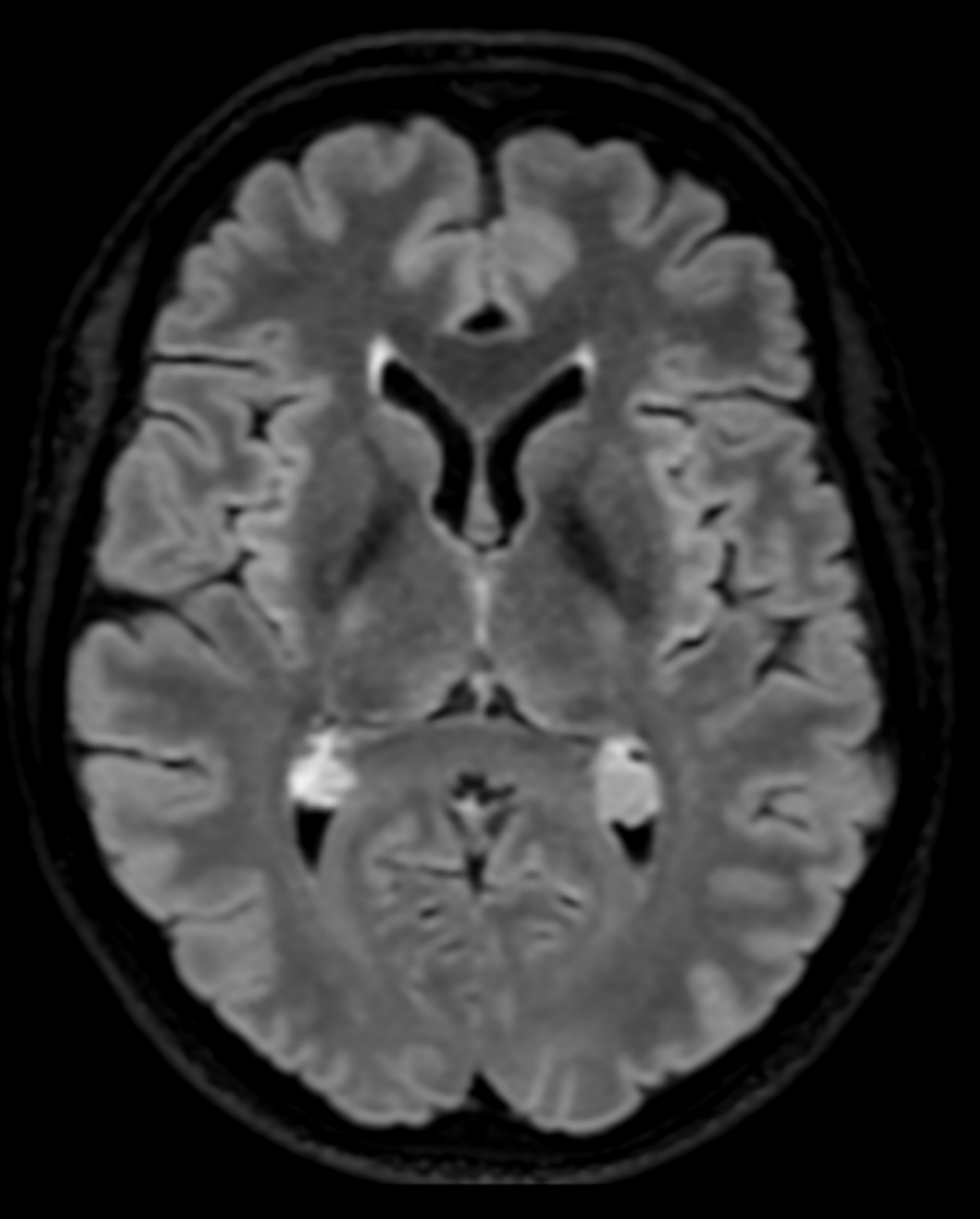 Neuroradiologie