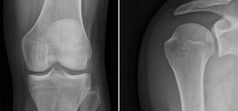 Bild aus der Radiologie, welche das Knie darstellen