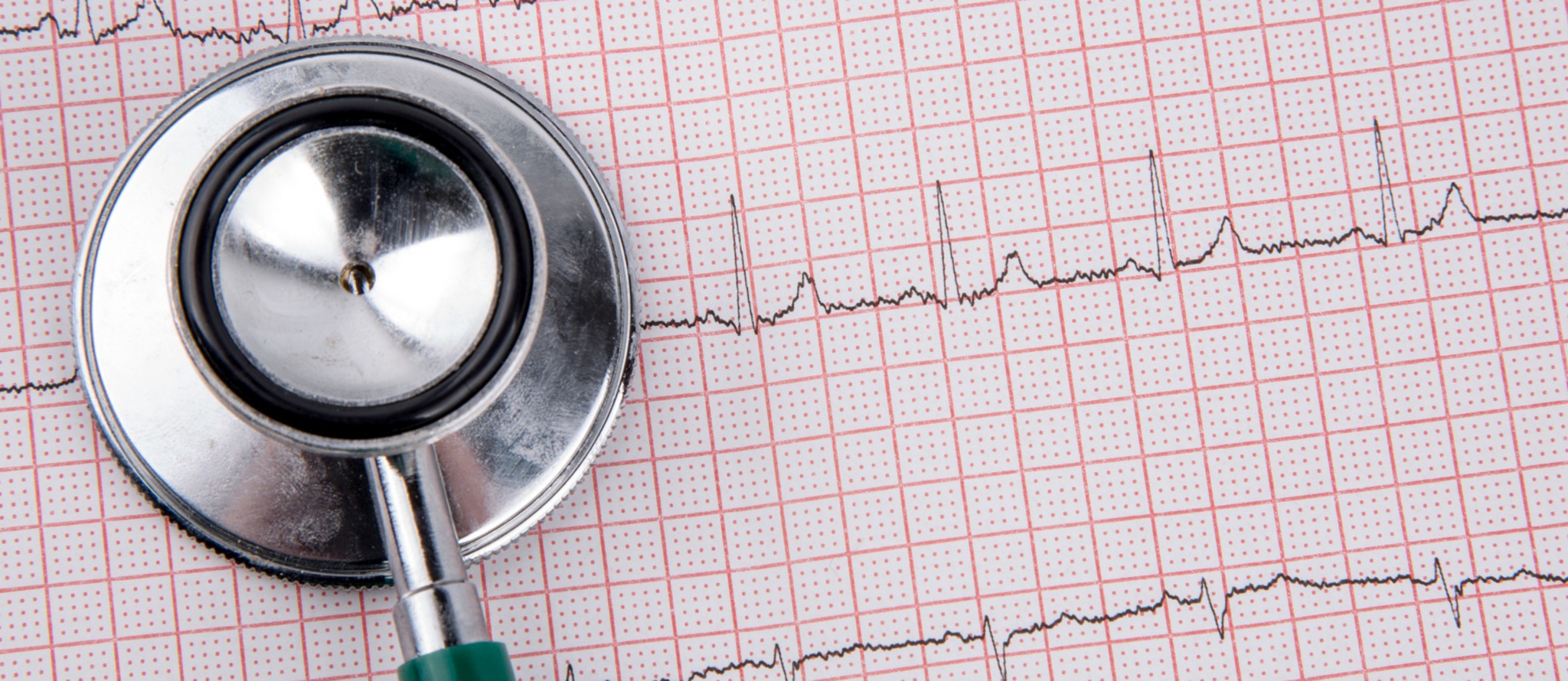 Stethoskop und ein EKG Bild 