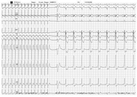 EKG-Bild EKG-Bild
