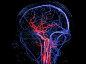 Darstellung der Hirngefässe (MR-Angiographie: rot: Arterien: blau: Venen)