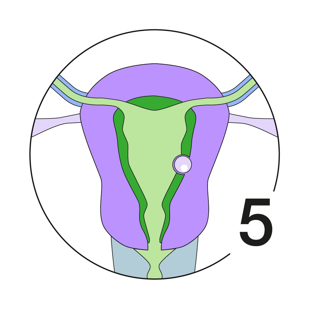 Illustration Menstruationszyklus